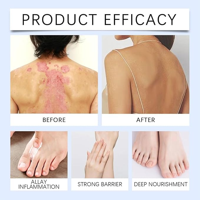 South Moon - Sugarguard Recovery Cream