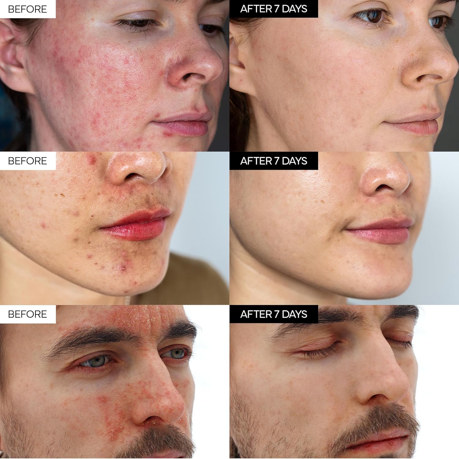 ivoskin - Intensive Cica Repair Cream
